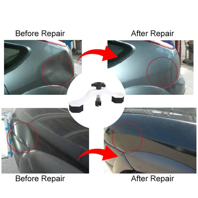 Car Dent Repair Device(1 Set)